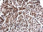 Calcineurin A Antibody in Immunohistochemistry (Paraffin) (IHC (P))