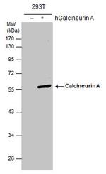 Calcineurin A Antibody in Western Blot (WB)