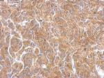 PAK1 Antibody in Immunohistochemistry (Paraffin) (IHC (P))