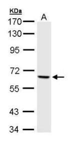 PAK1 Antibody in Western Blot (WB)