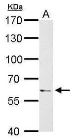 PAK1 Antibody in Western Blot (WB)