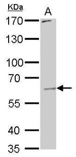 PAK1 Antibody in Western Blot (WB)