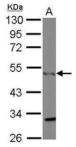 CtBP1 Antibody in Western Blot (WB)