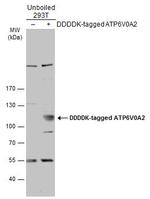 ATP6V0A2 Antibody in Western Blot (WB)