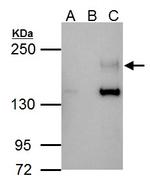 ErbB4 Antibody in Immunoprecipitation (IP)