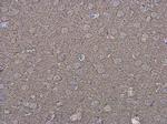 P2X7 Antibody in Immunohistochemistry (Paraffin) (IHC (P))