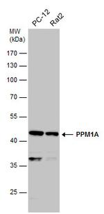 PPM1A Antibody in Western Blot (WB)