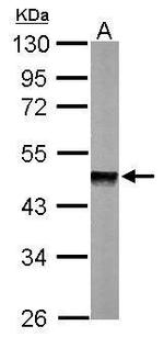 PPM1A Antibody in Western Blot (WB)