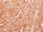 PLCG2 Antibody in Immunohistochemistry (Paraffin) (IHC (P))