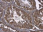 RUVBL1 Antibody in Immunohistochemistry (Paraffin) (IHC (P))