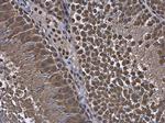 RUVBL1 Antibody in Immunohistochemistry (Paraffin) (IHC (P))