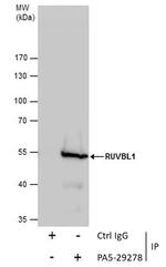 RUVBL1 Antibody in Immunoprecipitation (IP)