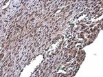 RSK2 Antibody in Immunohistochemistry (Paraffin) (IHC (P))