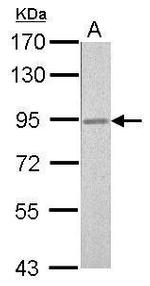 RSK2 Antibody in Western Blot (WB)