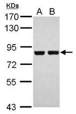 RSK2 Antibody in Western Blot (WB)