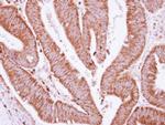 BCKDHA Antibody in Immunohistochemistry (Paraffin) (IHC (P))