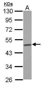 BCKDHA Antibody in Western Blot (WB)