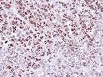 WEE1 Antibody in Immunohistochemistry (Paraffin) (IHC (P))