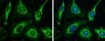 HK3 Antibody in Immunocytochemistry (ICC/IF)