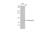 HK3 Antibody in Western Blot (WB)