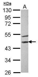 STK40 Antibody in Western Blot (WB)