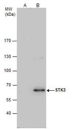 MST2 Antibody in Immunoprecipitation (IP)