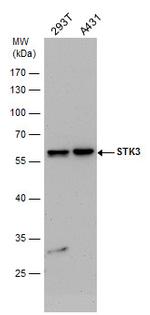 MST2 Antibody in Western Blot (WB)