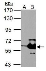 MST2 Antibody in Western Blot (WB)