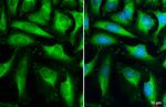 HK2 Antibody in Immunocytochemistry (ICC/IF)