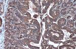 HK2 Antibody in Immunohistochemistry (Paraffin) (IHC (P))