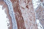 HK2 Antibody in Immunohistochemistry (Paraffin) (IHC (P))