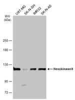 HK2 Antibody in Western Blot (WB)