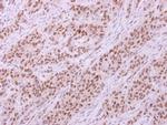 Lyn Antibody in Immunohistochemistry (Paraffin) (IHC (P))