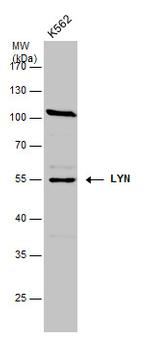 Lyn Antibody in Western Blot (WB)