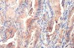 PKM2 Antibody in Immunohistochemistry (Paraffin) (IHC (P))