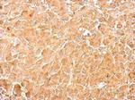 PKM2 Antibody in Immunohistochemistry (Paraffin) (IHC (P))