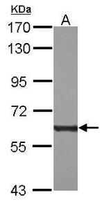 PKM2 Antibody in Western Blot (WB)