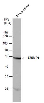 Fibulin 3 Antibody in Western Blot (WB)