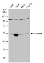 Fibulin 3 Antibody in Western Blot (WB)