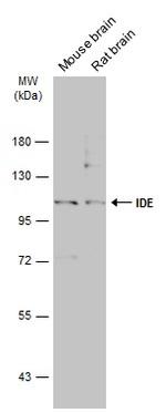 IDE Antibody in Western Blot (WB)