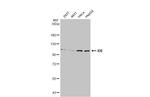 IDE Antibody in Western Blot (WB)