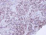 XRCC1 Antibody in Immunohistochemistry (Paraffin) (IHC (P))