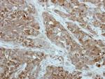 PFKFB1 Antibody in Immunohistochemistry (Paraffin) (IHC (P))