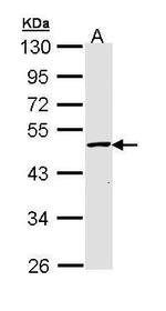 GALK2 Antibody in Western Blot (WB)