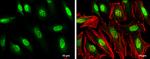 GTF2H1 Antibody in Immunocytochemistry (ICC/IF)