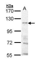 TRPM8 Antibody in Western Blot (WB)