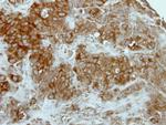 GCLM Antibody in Immunohistochemistry (Paraffin) (IHC (P))