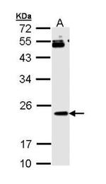 RAP1B Antibody in Western Blot (WB)