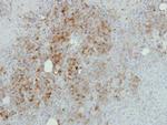 RPL17 Antibody in Immunohistochemistry (Paraffin) (IHC (P))