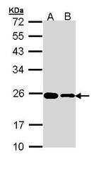 RPL17 Antibody in Western Blot (WB)